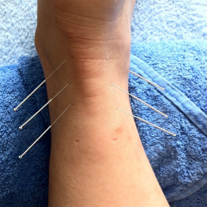 Musculoskeletal and Sports Injury CPD (Including Acupuncture)